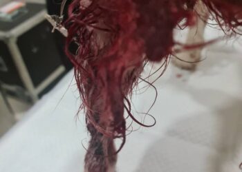 Κτηνώδης κακοποίηση σκύλου στα Κρέστενα Ηλείας